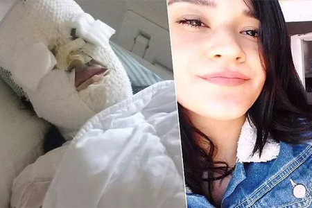 Asit saldırısına uğrayan Berfin Özek: Kadınlar yalnız olmadığımı hissettirdi