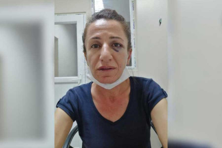 Gözaltına alınan TJA üyesi Sevil Rojbin Çetin darbedildi